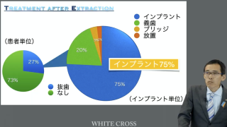 第4の歯科疾患 歯牙欠損進行症〜予防歯科を再考し、保険外診療の可能性